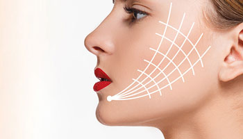 Thread Lift