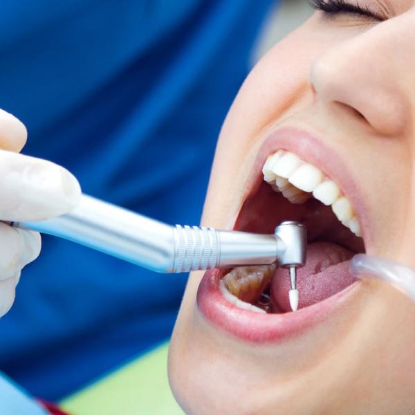 Root Canal Treatment